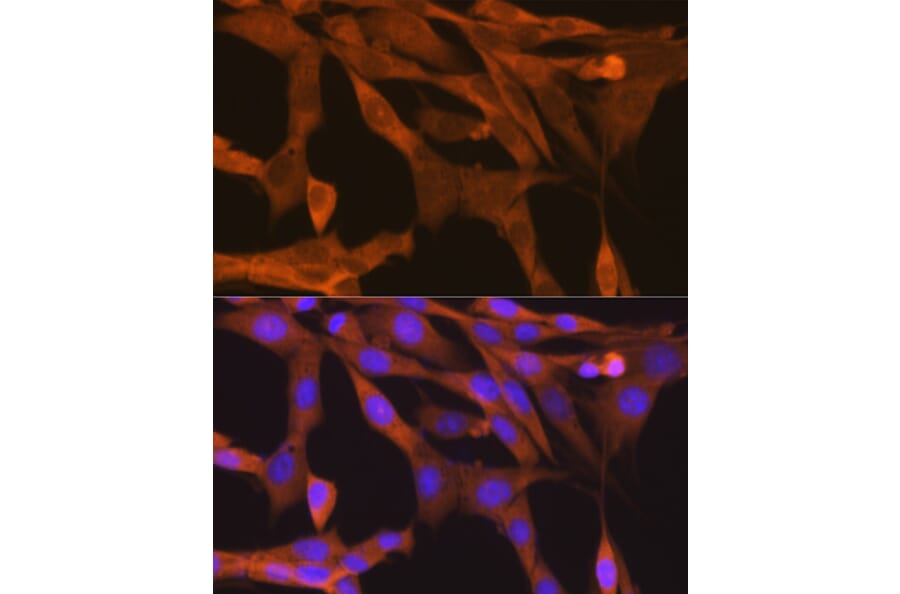 Immunofluorescence - Anti-NAK/TBK1 Antibody [ARC0778] (A307679) - Antibodies.com
