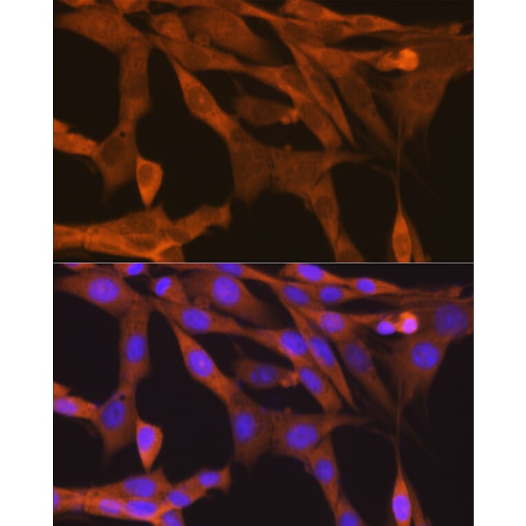 Immunofluorescence - Anti-NAK/TBK1 Antibody [ARC0778] (A307679) - Antibodies.com