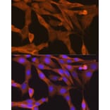 Immunofluorescence - Anti-NAK/TBK1 Antibody [ARC0778] (A307679) - Antibodies.com