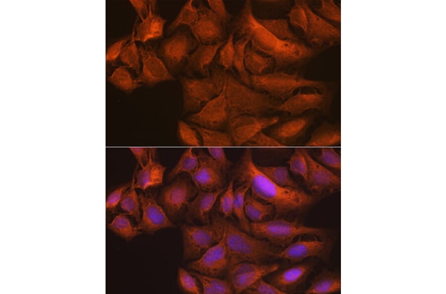 Immunofluorescence - Anti-NAK/TBK1 Antibody [ARC0778] (A307679) - Antibodies.com