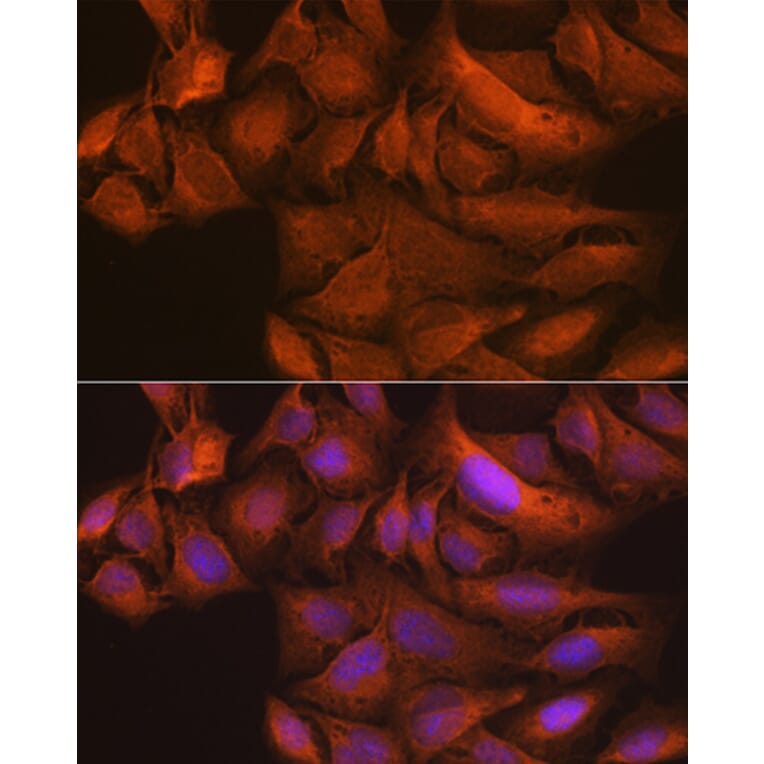 Immunofluorescence - Anti-NAK/TBK1 Antibody [ARC0778] (A307679) - Antibodies.com