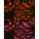 Immunofluorescence - Anti-NAK/TBK1 Antibody [ARC0778] (A307679) - Antibodies.com