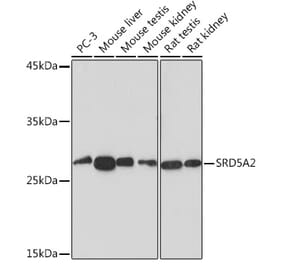 Western Blot - Anti-SRD5A2 Antibody [ARC2287] (A307681) - Antibodies.com