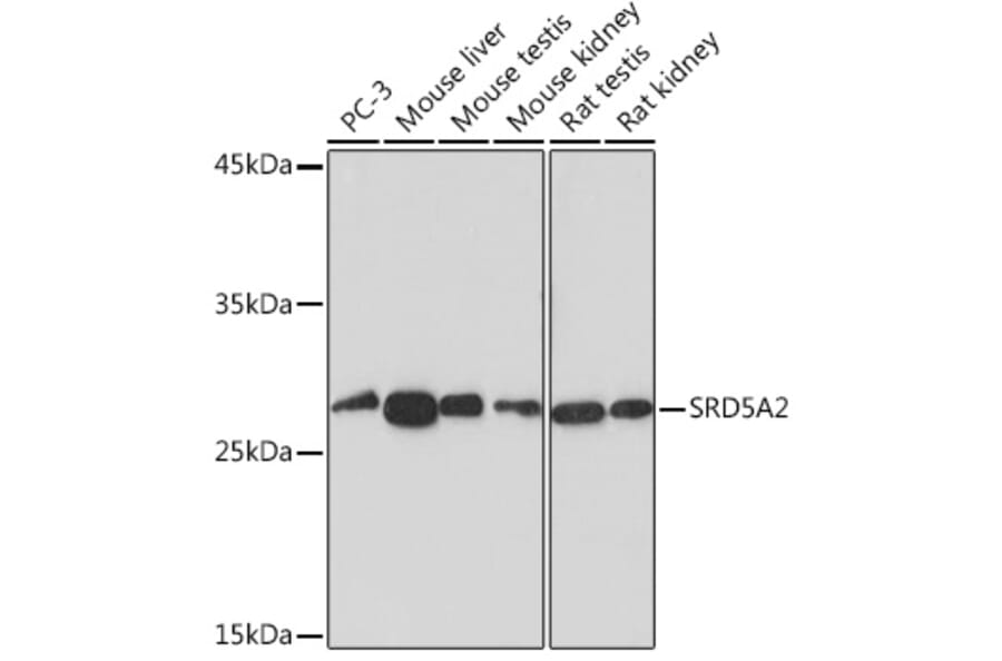 Western Blot - Anti-SRD5A2 Antibody [ARC2287] (A307681) - Antibodies.com