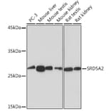 Western Blot - Anti-SRD5A2 Antibody [ARC2287] (A307681) - Antibodies.com