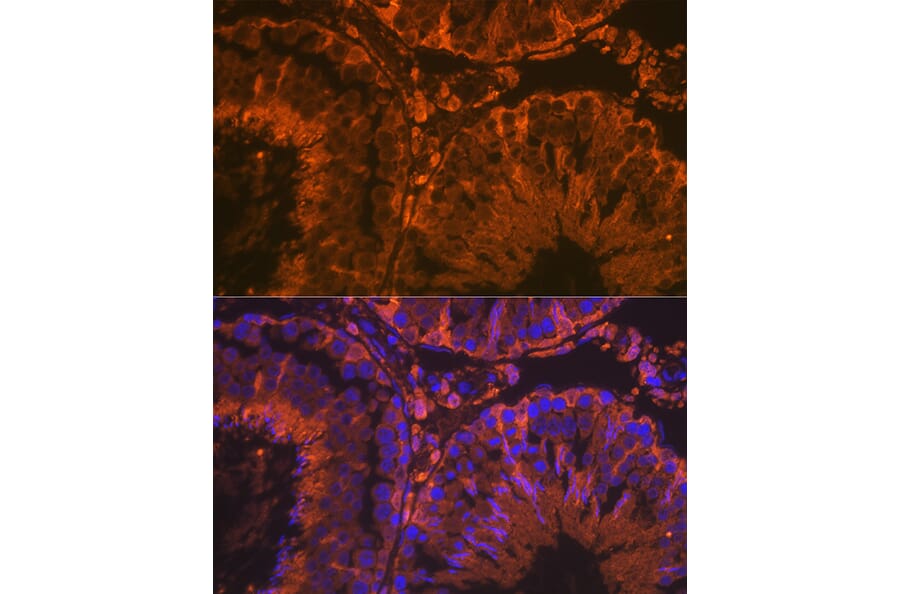 Immunofluorescence - Anti-SRD5A2 Antibody [ARC2287] (A307681) - Antibodies.com