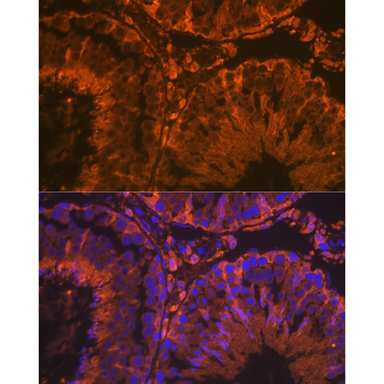 Immunofluorescence - Anti-SRD5A2 Antibody [ARC2287] (A307681) - Antibodies.com