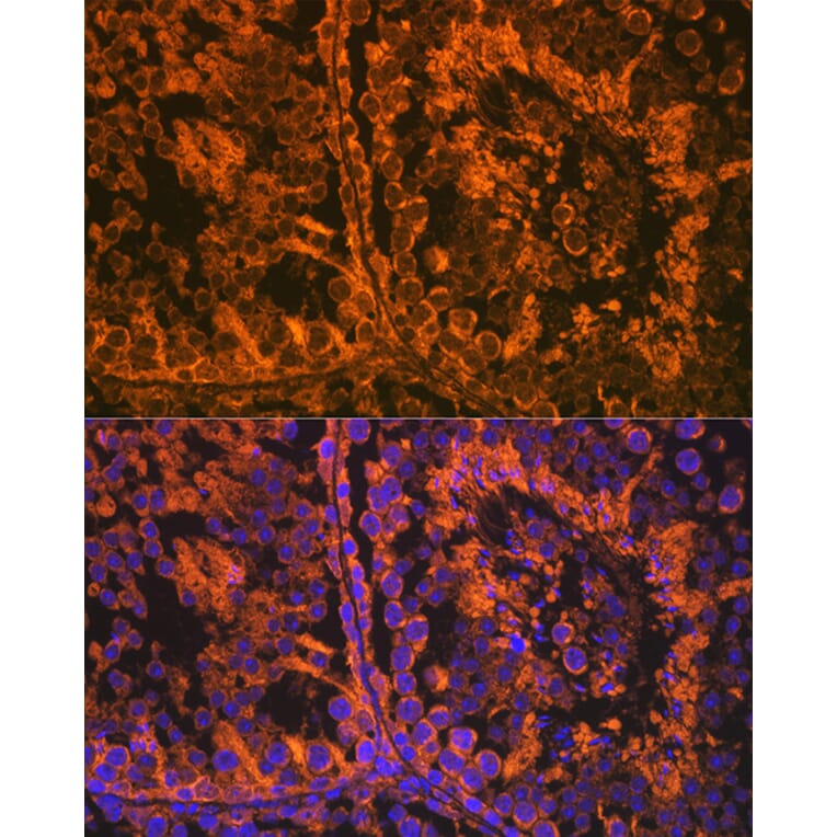 Immunofluorescence - Anti-SRD5A2 Antibody [ARC2287] (A307681) - Antibodies.com