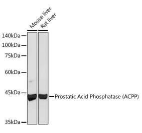 Western Blot - Anti-PAP Antibody [ARC2124] (A307682) - Antibodies.com