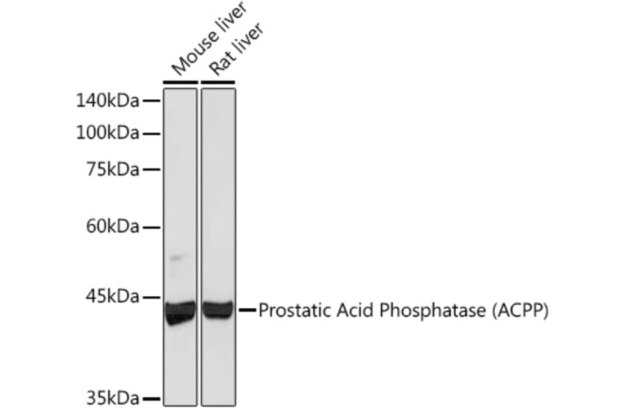 Western Blot - Anti-PAP Antibody [ARC2124] (A307682) - Antibodies.com