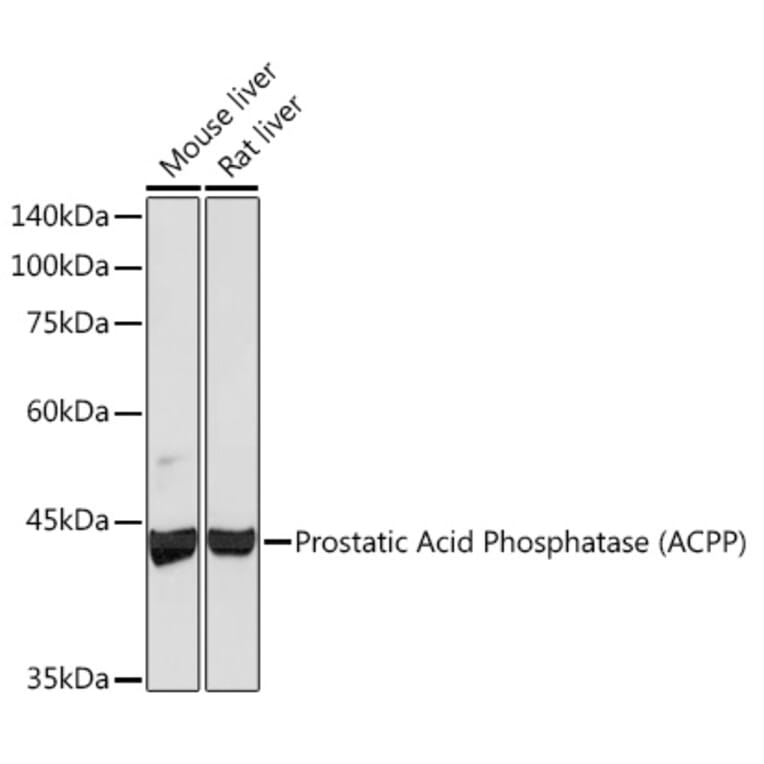 Western Blot - Anti-PAP Antibody [ARC2124] (A307682) - Antibodies.com