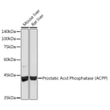 Western Blot - Anti-PAP Antibody [ARC2124] (A307682) - Antibodies.com