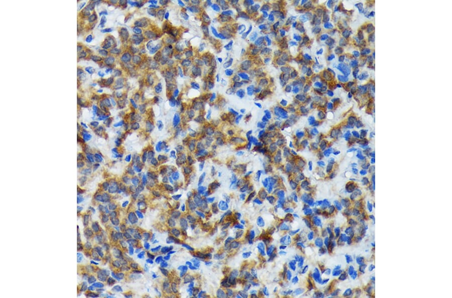 Immunohistochemistry - Anti-Thyroid Peroxidase/TPO Antibody (A307683) - Antibodies.com