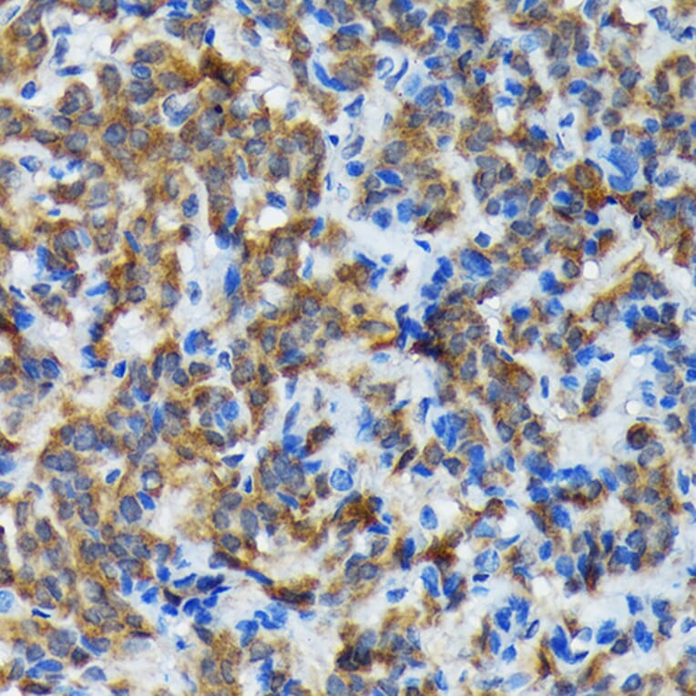 Immunohistochemistry - Anti-Thyroid Peroxidase/TPO Antibody (A307683) - Antibodies.com