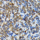 Immunohistochemistry - Anti-Thyroid Peroxidase/TPO Antibody (A307683) - Antibodies.com
