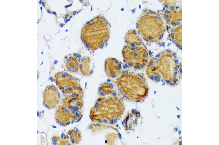 Immunohistochemistry - Anti-Thyroid Peroxidase/TPO Antibody (A307683) - Antibodies.com