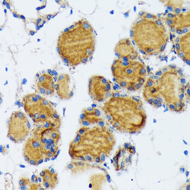Immunohistochemistry - Anti-Thyroid Peroxidase/TPO Antibody (A307683) - Antibodies.com