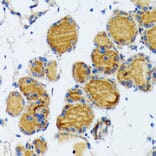 Immunohistochemistry - Anti-Thyroid Peroxidase/TPO Antibody (A307683) - Antibodies.com