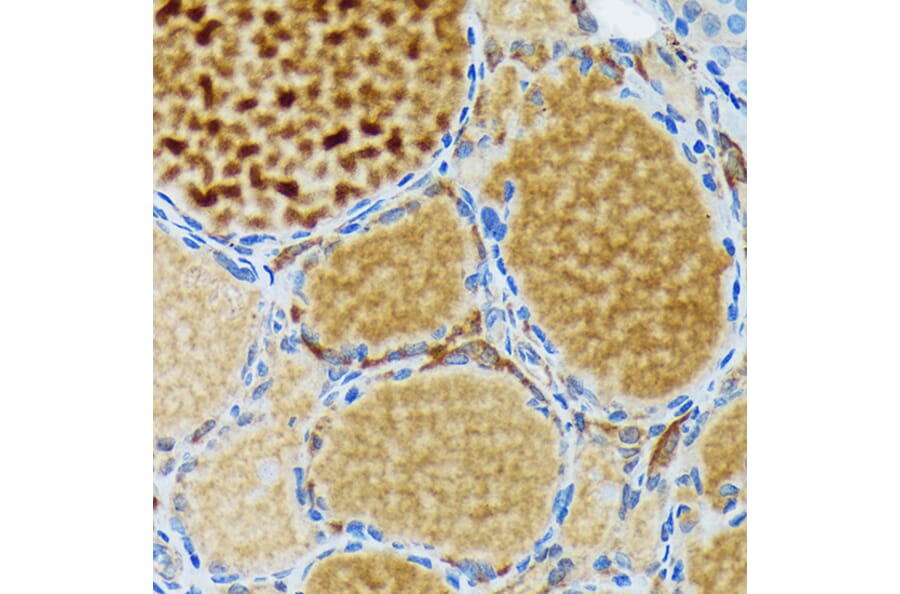 Immunohistochemistry - Anti-Thyroid Peroxidase/TPO Antibody (A307683) - Antibodies.com