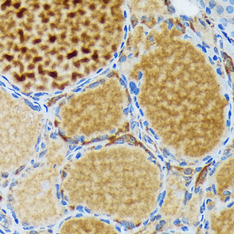 Immunohistochemistry - Anti-Thyroid Peroxidase/TPO Antibody (A307683) - Antibodies.com