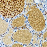 Immunohistochemistry - Anti-Thyroid Peroxidase/TPO Antibody (A307683) - Antibodies.com