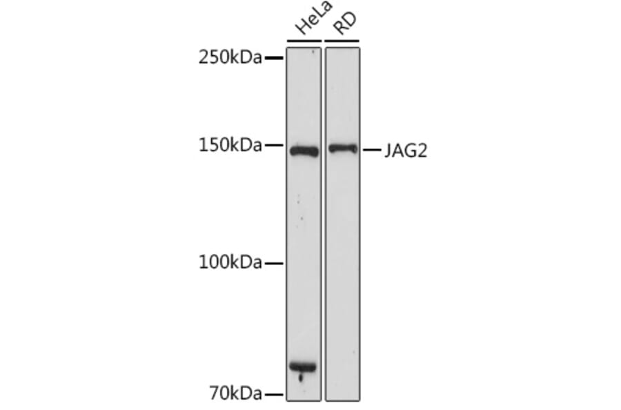 Western Blot - Anti-Jagged 2 / JAG2 Antibody [ARC2438] (A307684) - Antibodies.com