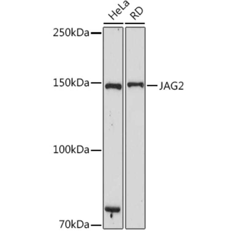 Western Blot - Anti-Jagged 2 / JAG2 Antibody [ARC2438] (A307684) - Antibodies.com
