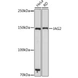 Western Blot - Anti-Jagged 2 / JAG2 Antibody [ARC2438] (A307684) - Antibodies.com