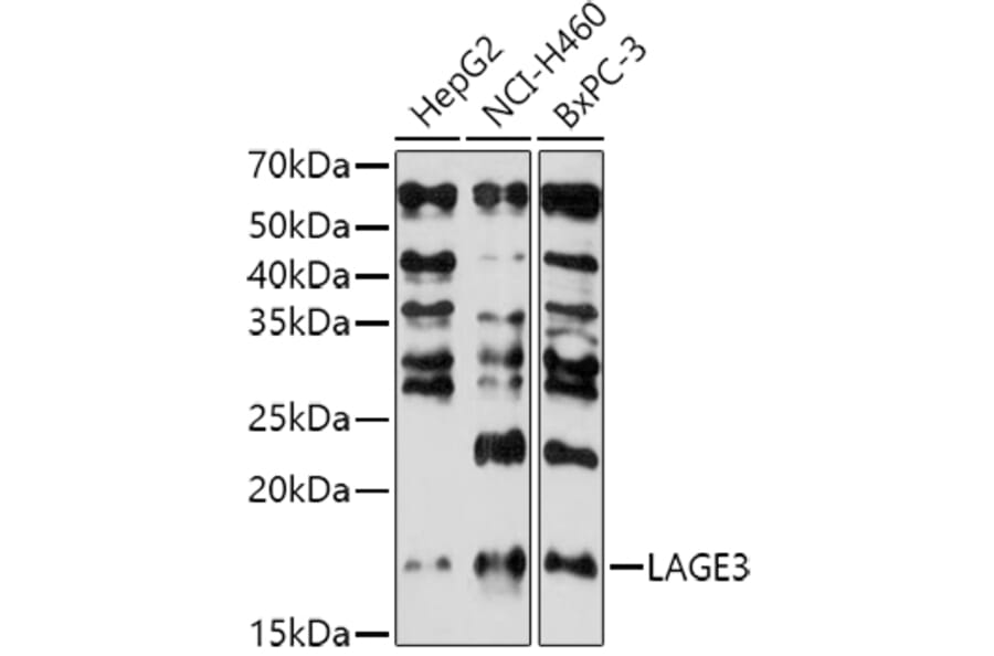 Western Blot - Anti-LAGE3 Antibody (A307685) - Antibodies.com