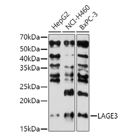 Western Blot - Anti-LAGE3 Antibody (A307685) - Antibodies.com