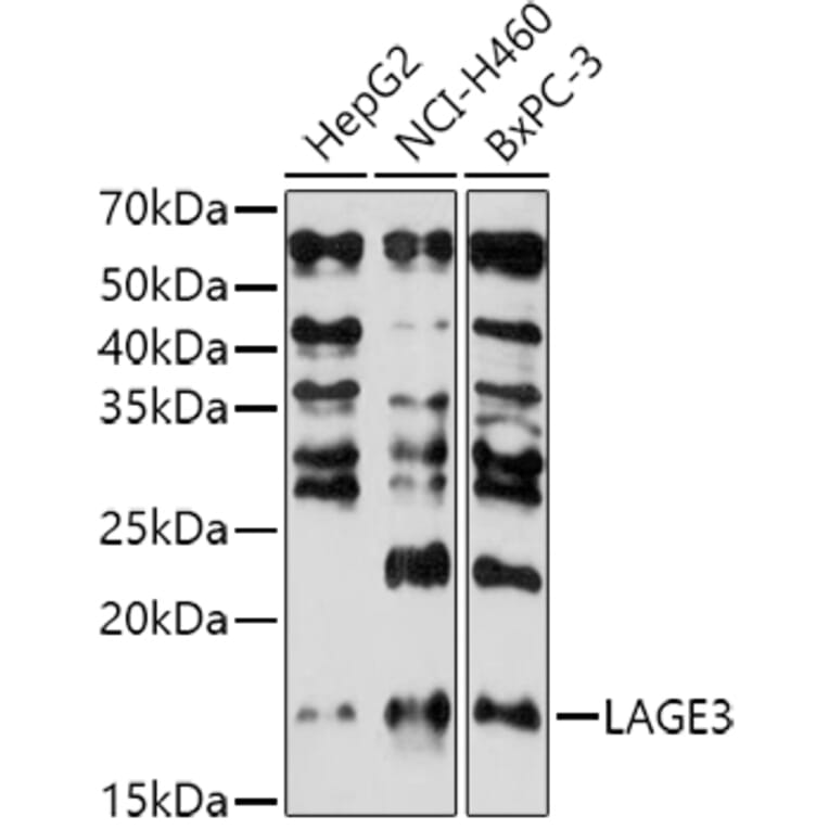 Western Blot - Anti-LAGE3 Antibody (A307685) - Antibodies.com