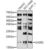 Western Blot - Anti-LAGE3 Antibody (A307685) - Antibodies.com