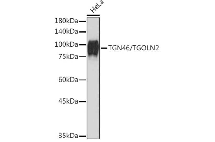 Western Blot - Anti-TGN46 Antibody [ARC2197] (A307687) - Antibodies.com