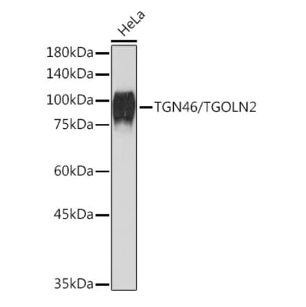 Western Blot - Anti-TGN46 Antibody [ARC2197] (A307687) - Antibodies.com