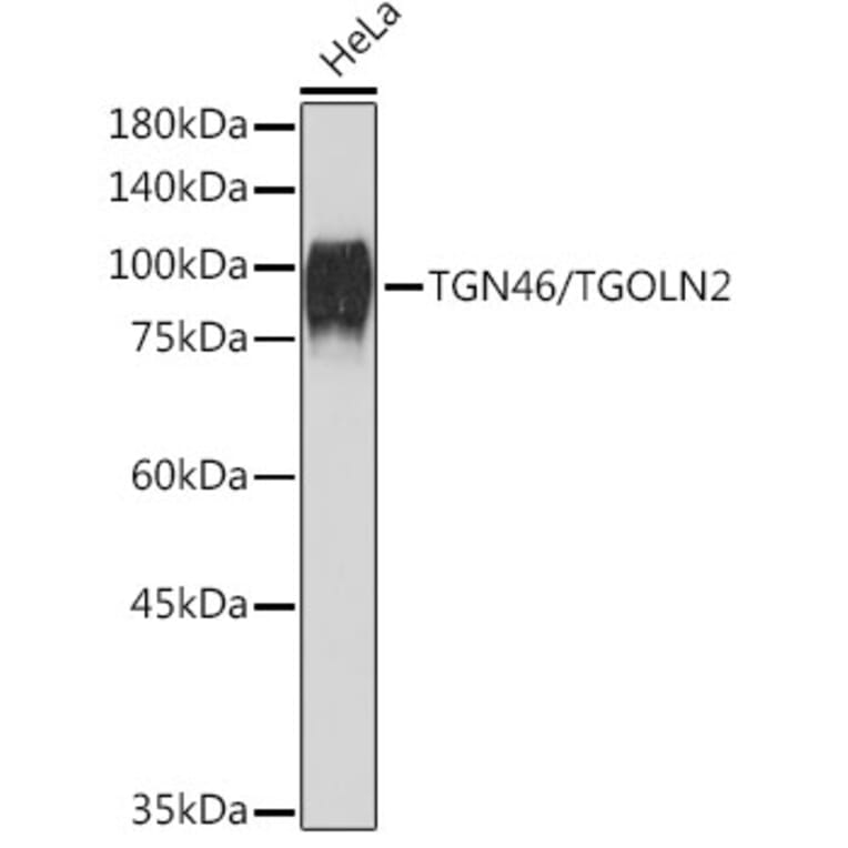Western Blot - Anti-TGN46 Antibody [ARC2197] (A307687) - Antibodies.com
