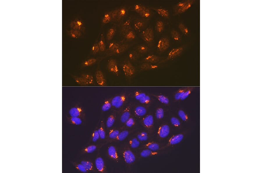Immunofluorescence - Anti-TGN46 Antibody [ARC2197] (A307687) - Antibodies.com