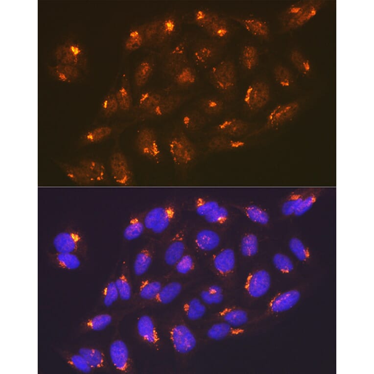 Immunofluorescence - Anti-TGN46 Antibody [ARC2197] (A307687) - Antibodies.com
