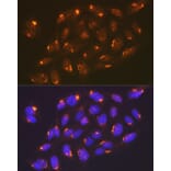 Immunofluorescence - Anti-TGN46 Antibody [ARC2197] (A307687) - Antibodies.com