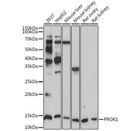 Western Blot - Anti-EG-VEGF Antibody [ARC2439] (A307688) - Antibodies.com