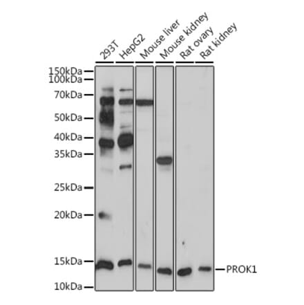 Western Blot - Anti-EG-VEGF Antibody [ARC2439] (A307688) - Antibodies.com