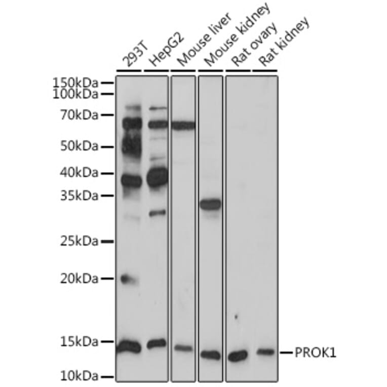 Western Blot - Anti-EG-VEGF Antibody [ARC2439] (A307688) - Antibodies.com