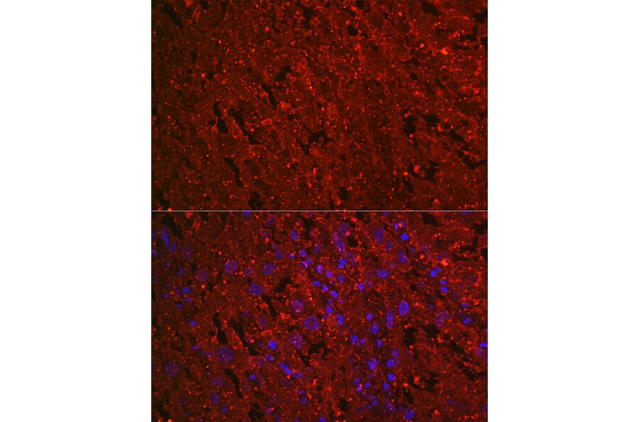 Immunofluorescence - Anti-EG-VEGF Antibody [ARC2439] (A307688) - Antibodies.com