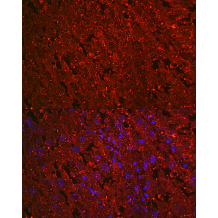 Immunofluorescence - Anti-EG-VEGF Antibody [ARC2439] (A307688) - Antibodies.com