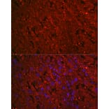 Immunofluorescence - Anti-EG-VEGF Antibody [ARC2439] (A307688) - Antibodies.com