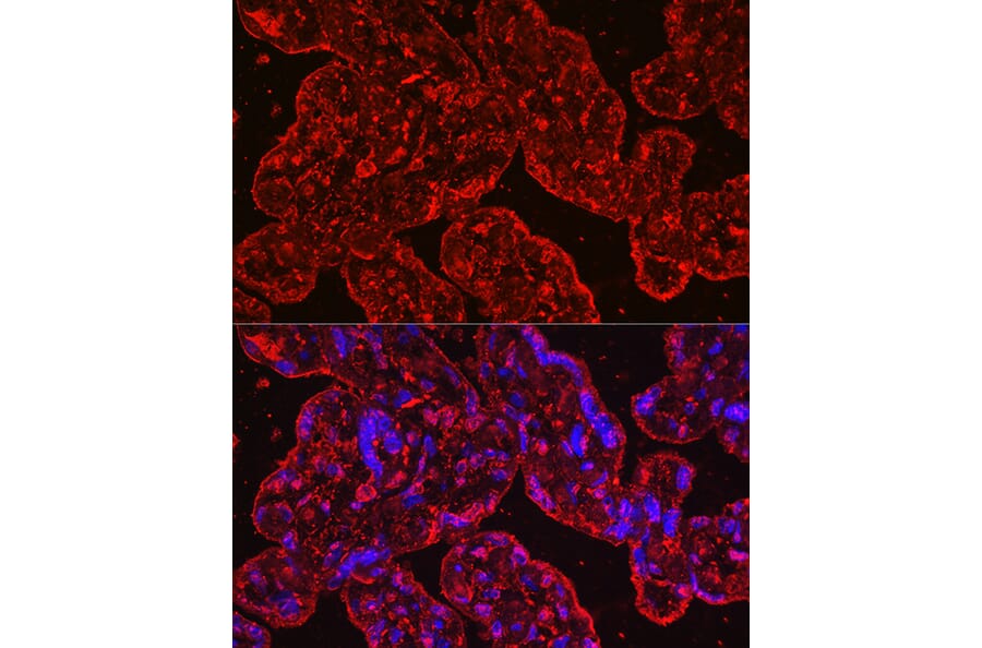 Immunofluorescence - Anti-EG-VEGF Antibody [ARC2439] (A307688) - Antibodies.com