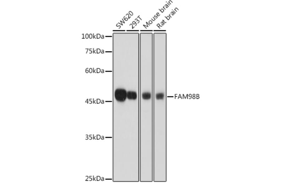 Western Blot - Anti-FAM98B Antibody (A307689) - Antibodies.com