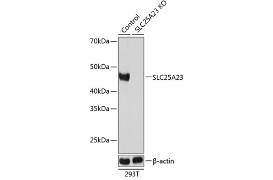 Western Blot - Anti-SLC25A23 Antibody (A307690) - Antibodies.com