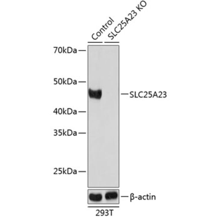 Western Blot - Anti-SLC25A23 Antibody (A307690) - Antibodies.com
