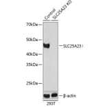 Western Blot - Anti-SLC25A23 Antibody (A307690) - Antibodies.com
