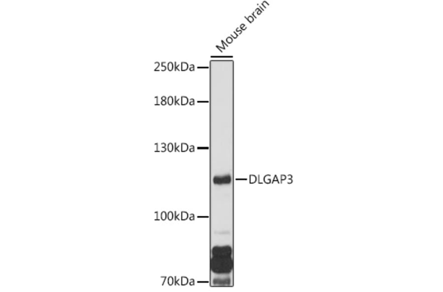 Western Blot - Anti-DLGAP3 Antibody (A307691) - Antibodies.com